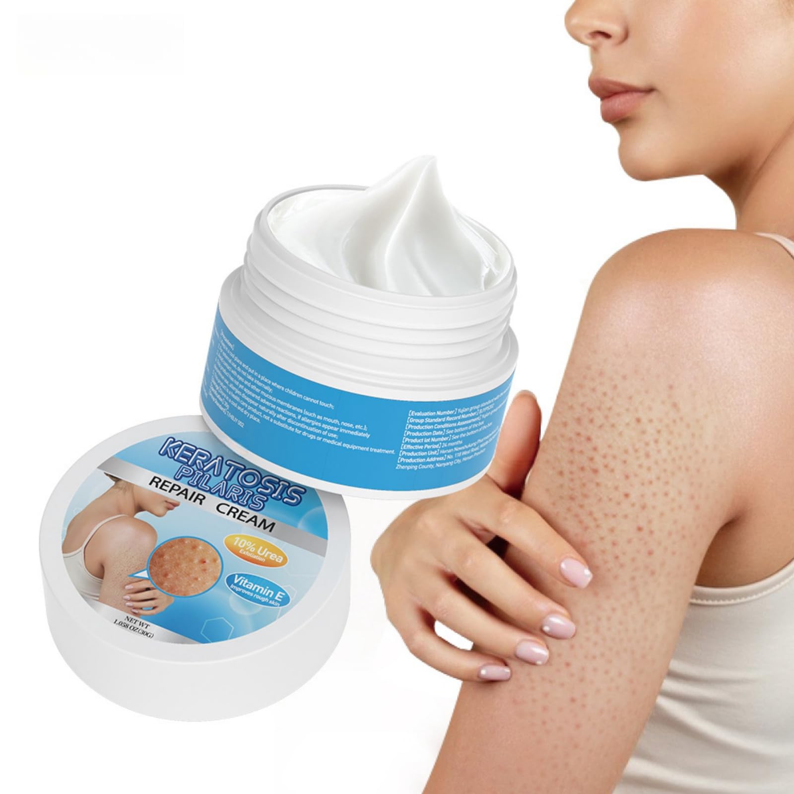 glutathione for keratosis pilaris 13 Treatments Can Glutathione Help Keratosis Pilaris?