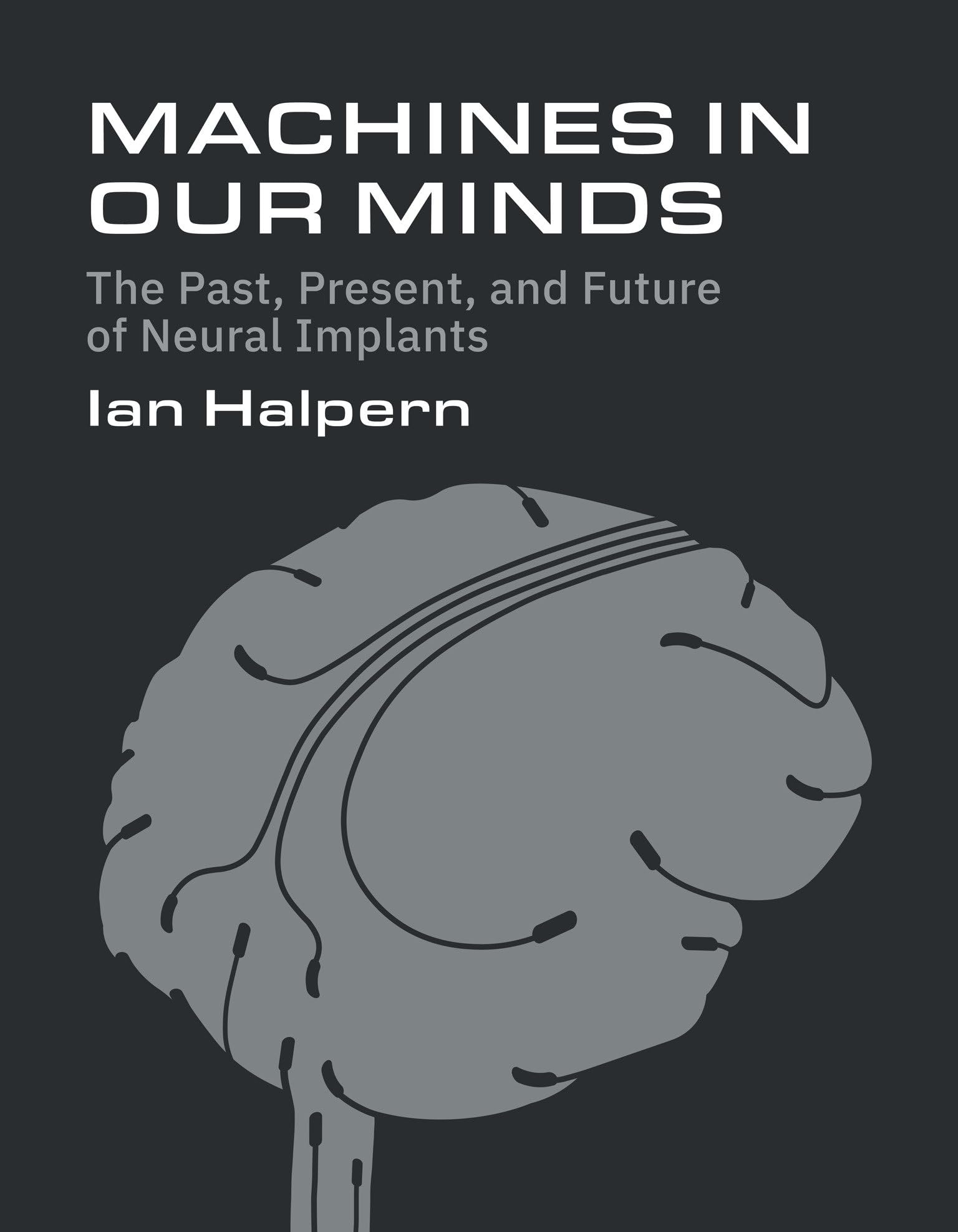 Machines in Our Minds: The Past, Present, and Future of Neural Implants