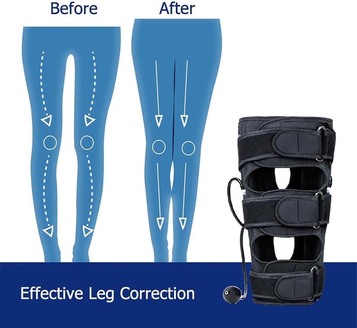 KEULEN O/X Leg Correction Belt, Adjustable Valgus Deformity Straighten Belt, Air Bag Pressurization On Both Sides and Removable Aluminum Plate Support, Legs Posture Corrector, for Adult Unisex