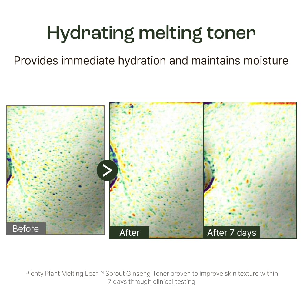 Plentyplant Melting Sprout Ginseng Face Toner, Beauty of Ginseng Essence Water Hydrating Face Toner for Oily and Aging Skin, Korean Moisturizing Skin Care for Men and Women 150ml, 5 fl.oz