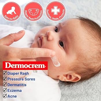 Amazon.com: DERMOCREM 2.1 Oz (60 Gr) Diaper Rash Cream for