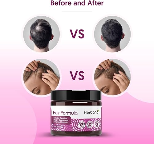 Miniatura 6 de Fórmula capilar para hombres y mujeres, 30 cápsulas - 23 ingredientes activos para un crecimiento y grosor más rápidos del cabello con biotina 6000