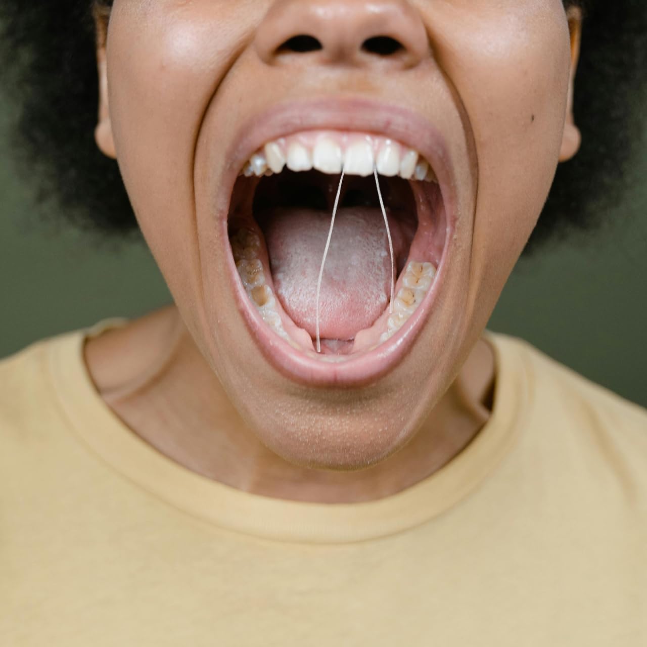 Cabilock 10Pcs Dental Floss Core Refill 50M Polyester Thread Spool Reusable Tooth Flosser Replacement for Oral Care, Braces & Sensitive Gums | Unflavored Bulk String