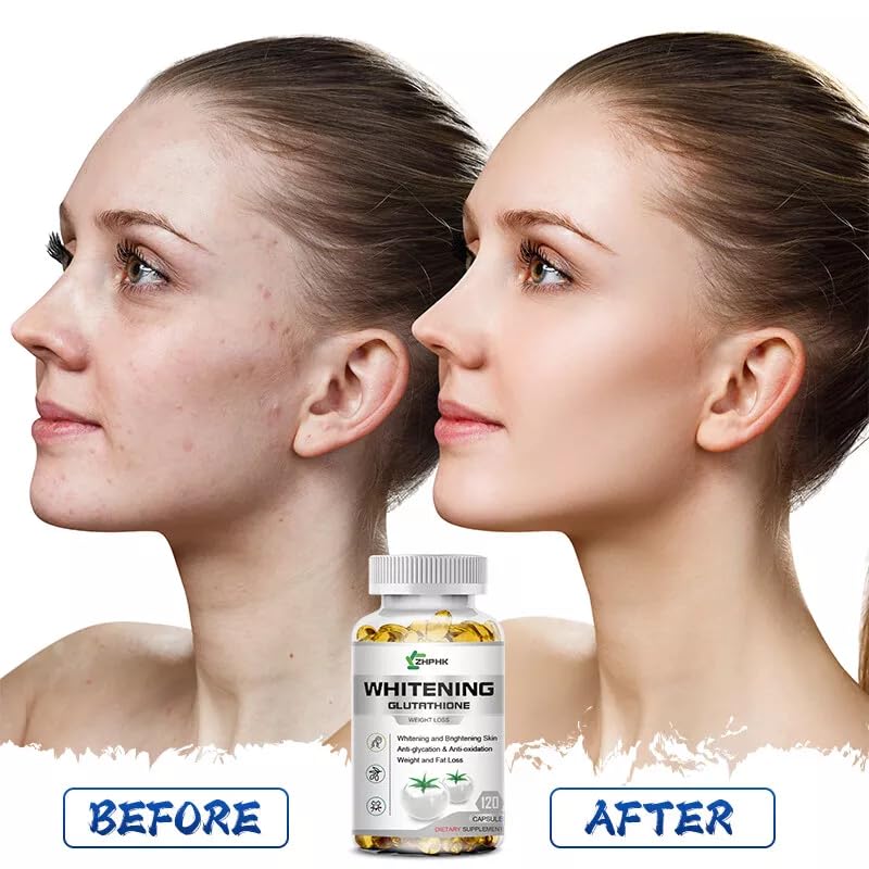 cla or l carnitine better cla or l carnitine better L-CARNITINA 3000 cla or l carnitine better cla or l carnitine better L-CARNITINA 3000