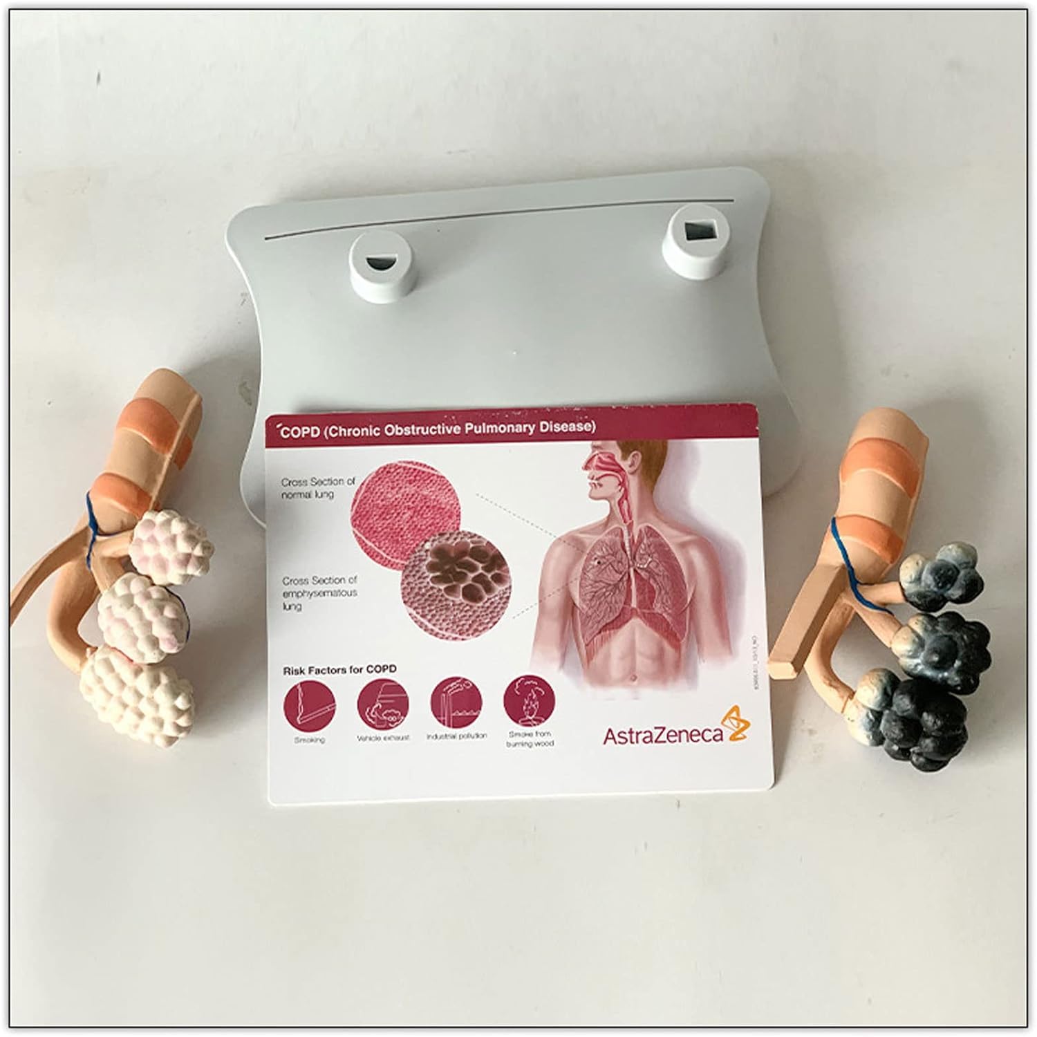 Modèle alvéolaire de la santé pulmonaire chez le fumeur, modèle de poumon sain, avec caractéristiques pathologiques et structure anatomique précise pour les effets du tabagisme sur la santé pulmonaire