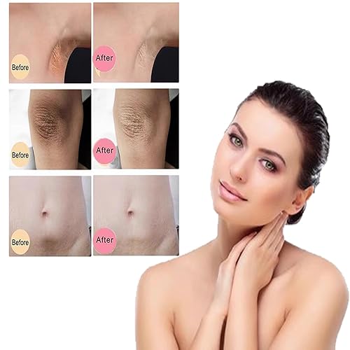 Miniatura 5 de Omaky Crema natural para la piel, crema para las axilas, crema para el cuidado de la piel, corrección de partes oscuras para cuello, rodillas,