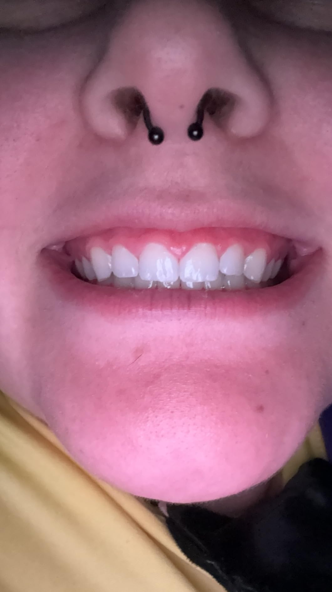 amazing after only 3 days!