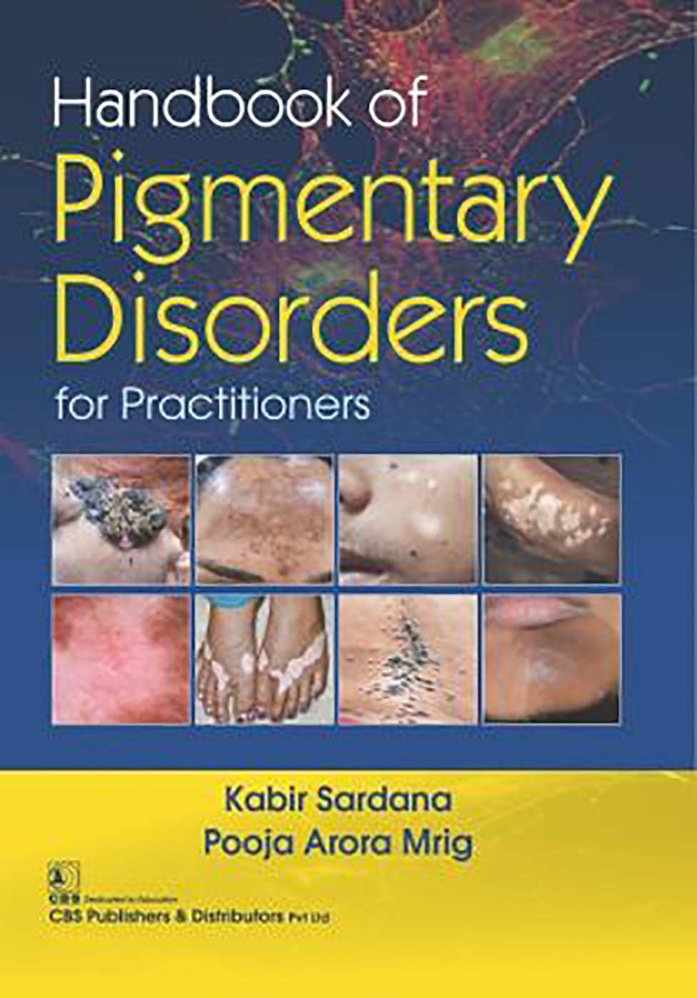 Handbook Of Pigmentary Disorders