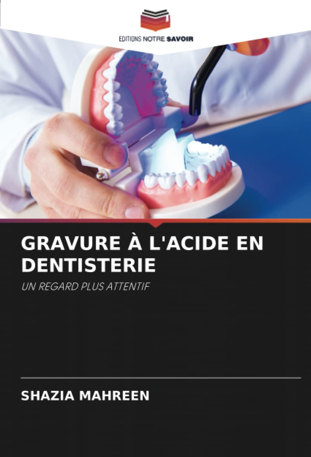 GRAVURE À L'ACIDE EN DENTISTERIE: UN REGARD PLUS ATTENTIF