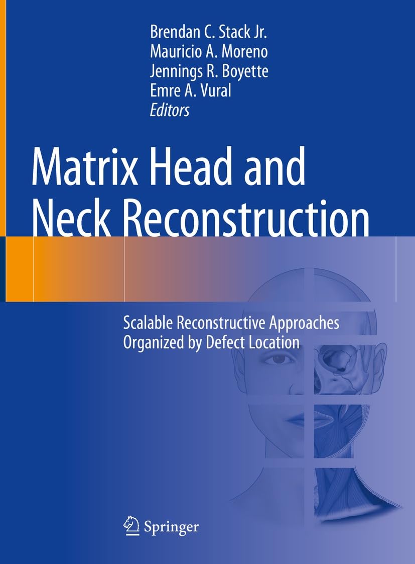 Amazon | Matrix Head and Neck Reconstruction: Scalable Reconstructive ...