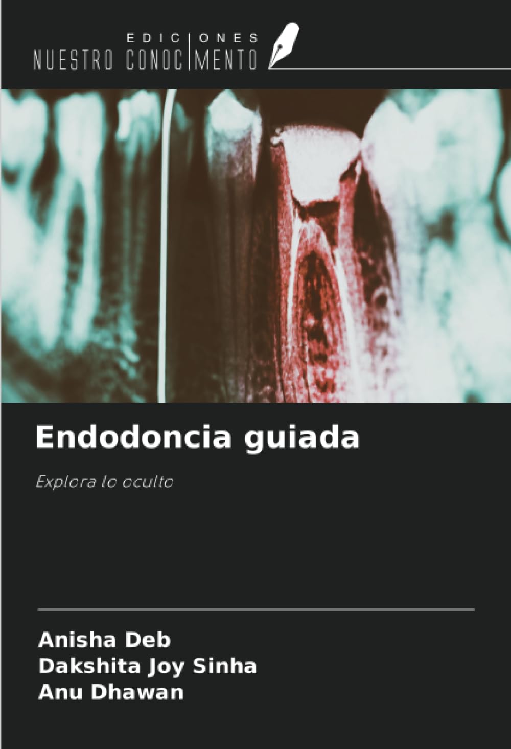 Endodoncia guiada: Explora lo oculto