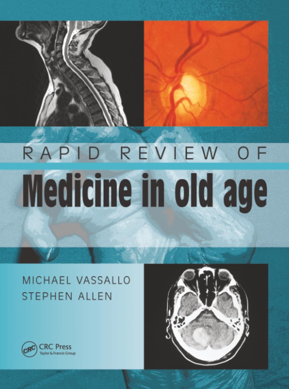 Rapid Review of Medicine in Old Age (Medical Rapid Review Series)