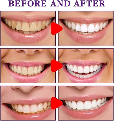Miniatura 4 de Pasta de dientes probióticos para el mal aliento, pasta de dientes equilibrada del aire del océano (1 piezas)