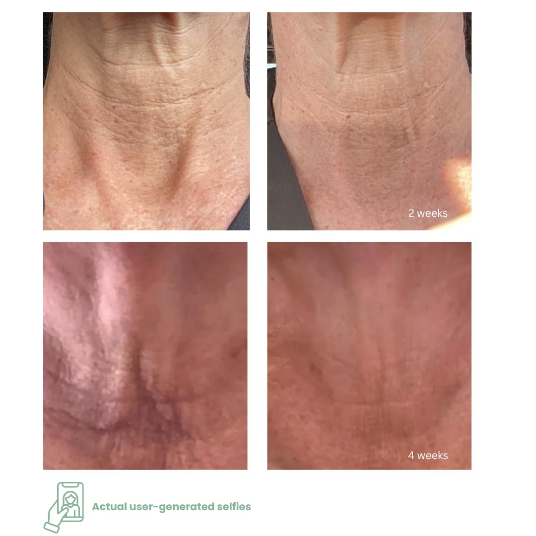 NECK+ Regenerative Cream, Collagen Boosting Neck Cream, Firms,Tightens, Lifts, with Peptides & Growth Factor Complex, Gentle on Skin,Clinically Tested, 0.5 fl oz (Applicator Bundle) - Image 4