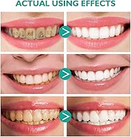 Vista 6 de 2 Pcs Foam Toothpaste, Ultra-fine Mousse Foam Deeply Cleaning Gums, Whitens Teeth & Deeply Gums Care & Easy to Use, 360ºCare for Oral Health, 60ml*2