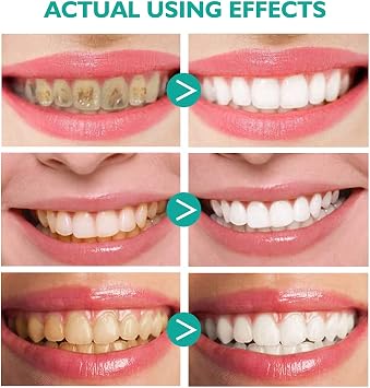 Teeth Whitening Toothpaste - Ultra-Fine Mousse Foam 60ml (2PCS) With Baking Soda for Foaming Whitening