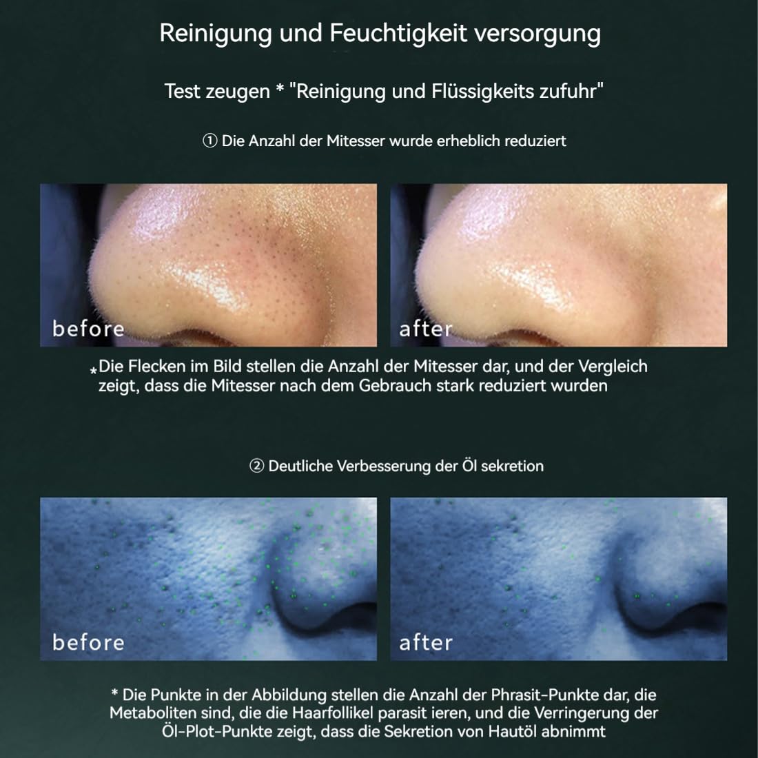 Multifunktionales AquaFacial-Gerät mit 5 Saugstufen & 10 Aufsätzen – Tiefenreinigung, Porenverfeinerung & Flüssigkeitsinfusion – Ideal für Home Spa & Reisen, Frauen & Männer