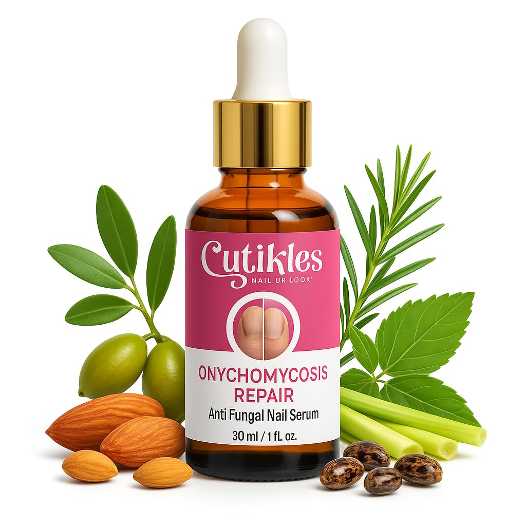 CUTIKLES Anti-Fungal Nail Repair Serum for Healthy Nails. Nourishes Nails, Helps Remedy Fungal Nail Infection, Damaged Nails & Ingrown Toe-Nail - 30ml