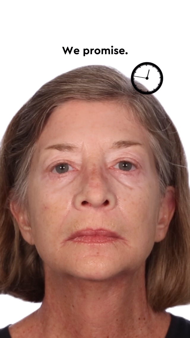 Amazon.com: Serious Skincare INSTA-TOX Instant Wrinkle Filler for