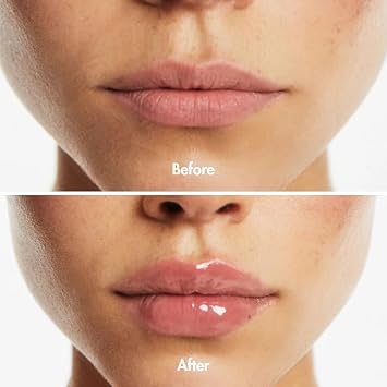 Smooche Normal Lip Plumper Hydrating Lip Volumizer Plumper with Natural Ingredients Includes Hyaluronic Acid & Collagen Long-Lasting Subtle Fuller Lips, Smoother, Softer, Naturally Plump & Glossy