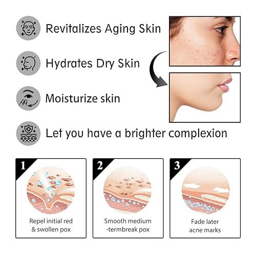 Miniatura 5 de Caracol Mucin Cream Advanced 92% Caracol Mucin Coreano Cuidado de la Piel Hidratante Hidratante Antienvejecimiento Antiarrugas para una piel