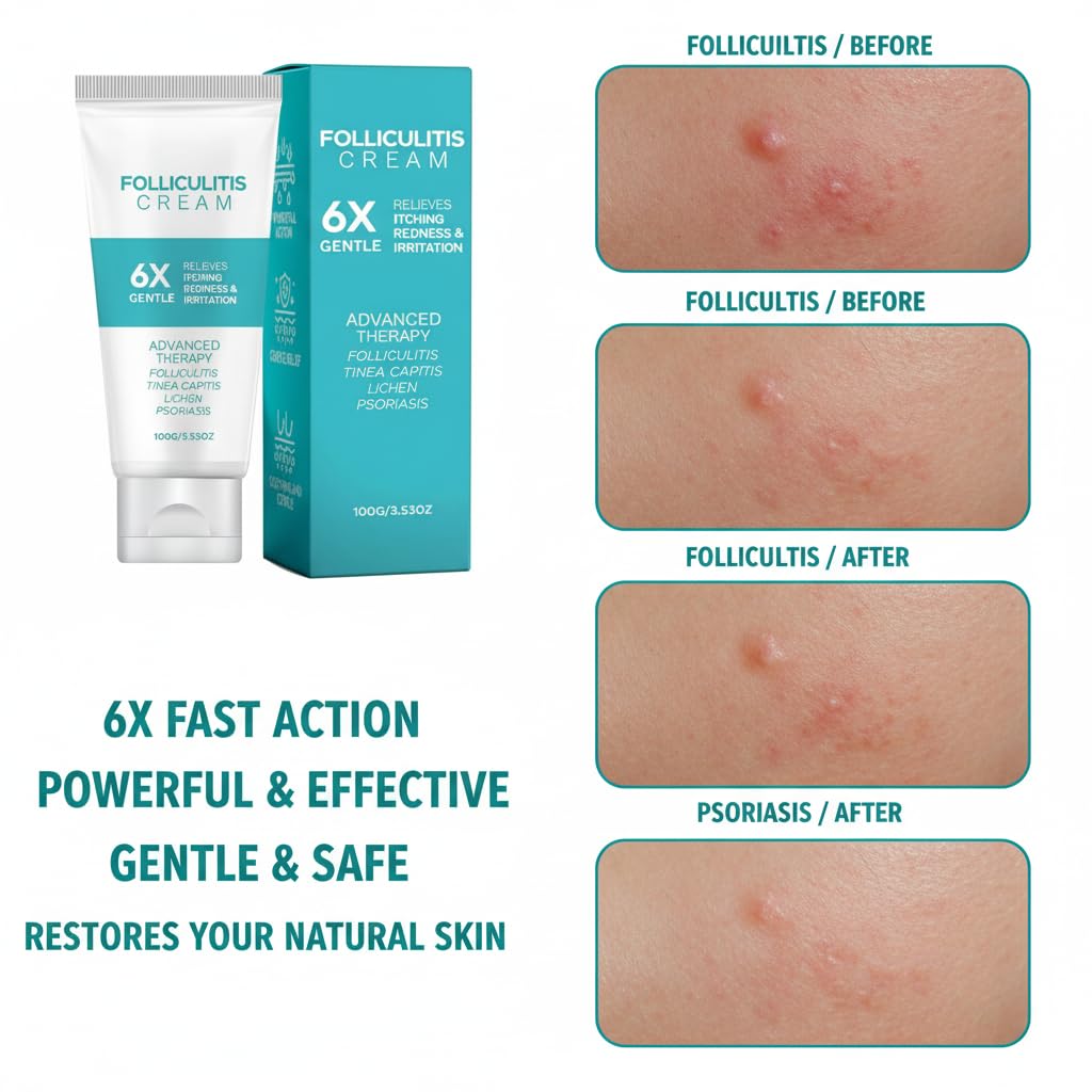 Folliculitis Cream 3.53oz – Cooling Relief for Itchy, Bumpy & Irritated Skin – Herbal Menthol Skin Cream for Scalp, Face & Body – Fast Absorbing Daily Use
