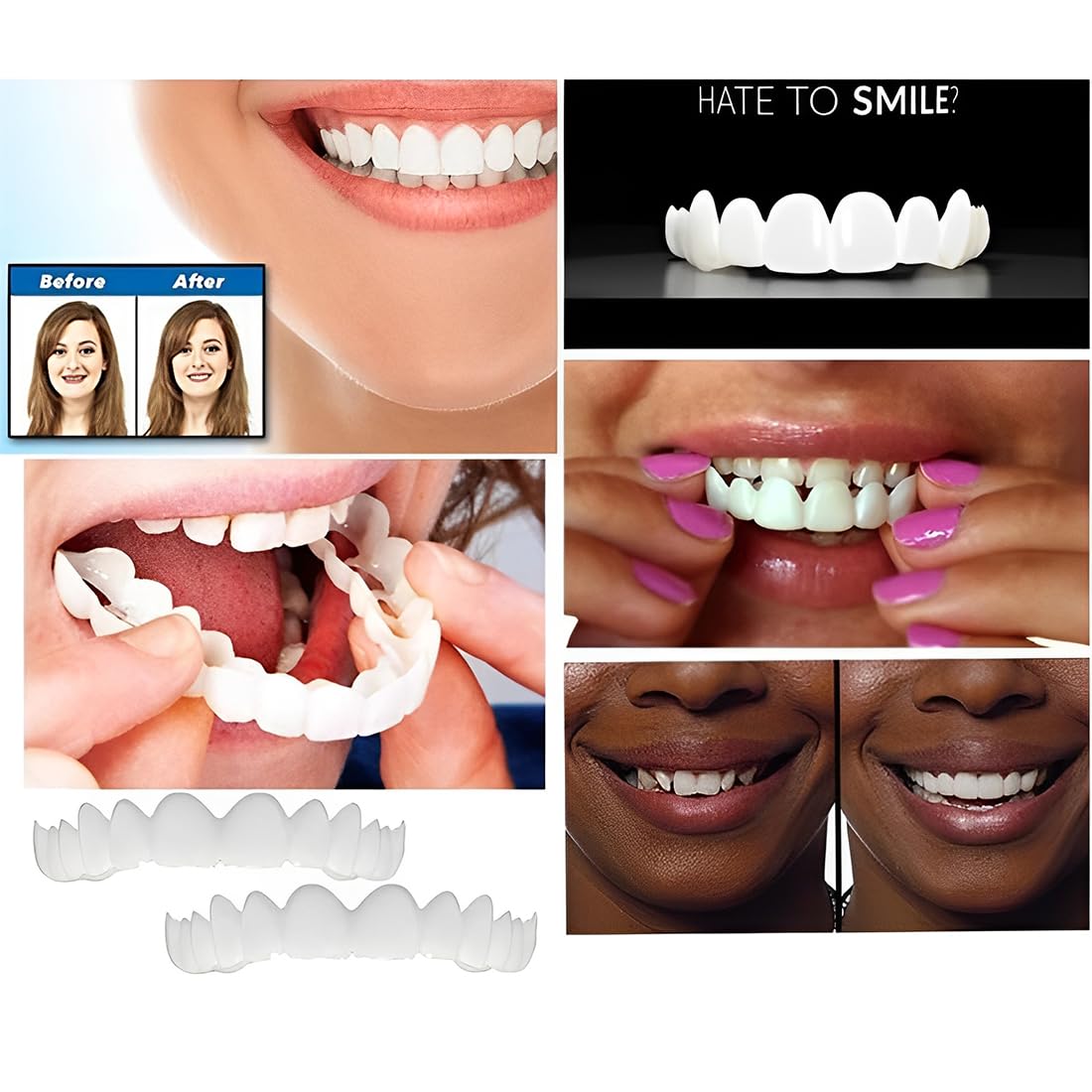 2 Pair Superiore Inferiore Denti,Faccette Denti Cosmetici,Superiore Inferiore Denti Cosmetici,Denti Temporanee,Cosmetici Copertina Orale Sbiancamento Dentale per Uomini e Donne