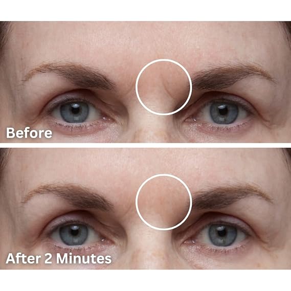 Dermaflage Scar Filler, Refill Applicator