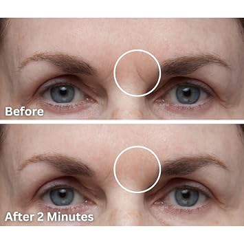 Dermaflage Scar Filler, Refill Applicator