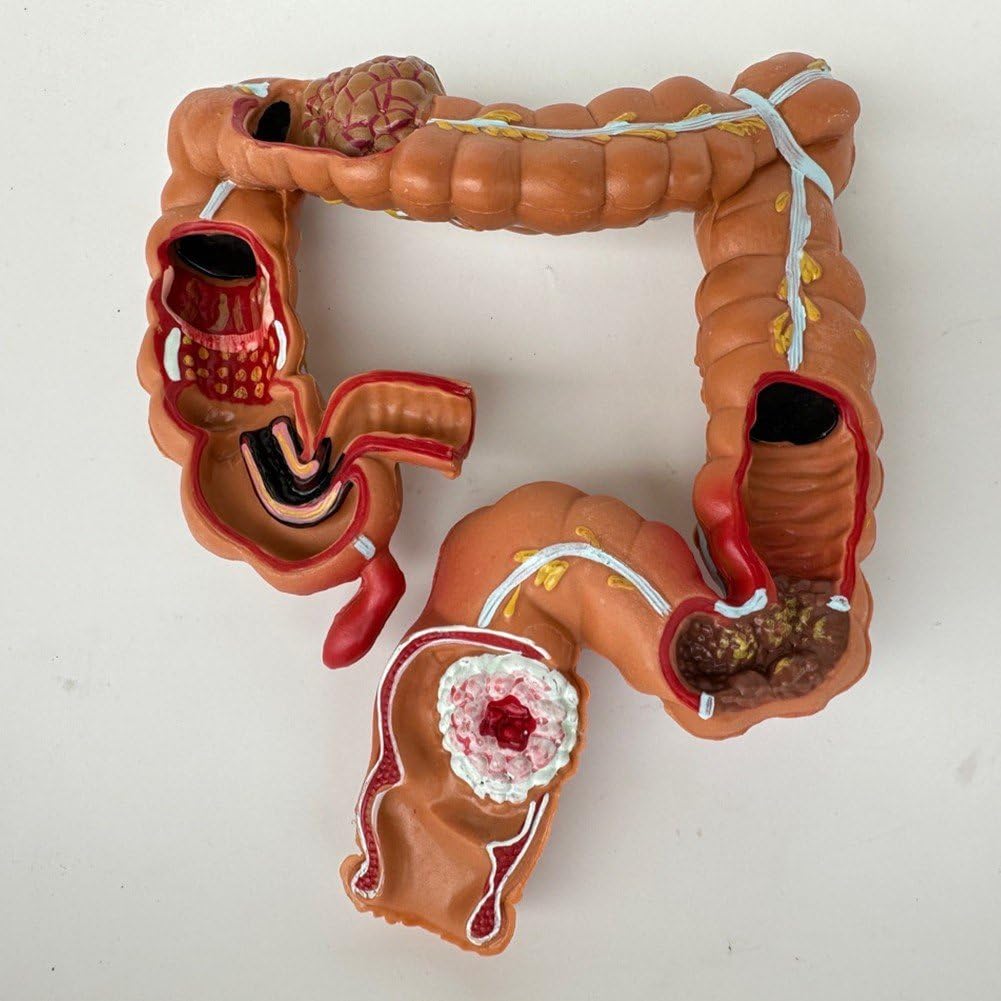 Sofezdo Human Colon Model Large Intestine Anatomical Model Human Anatomy Digestive System Display Model for Science Education