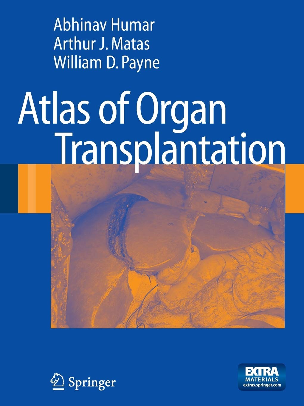 Atlas of Organ Transplantation