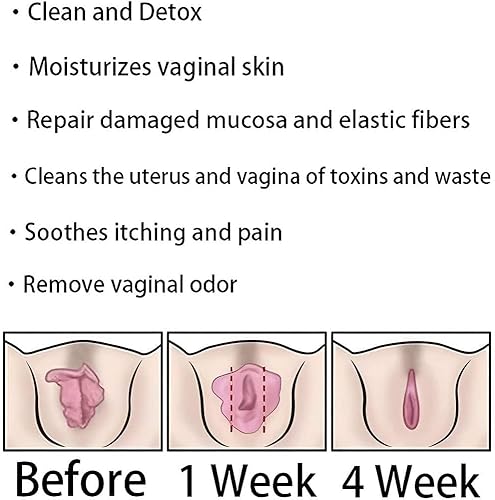 Miniatura 7 de Anniecare Natural Repair Viginal Capsule, Anniecare - Productos para adelgazar desintoxicación instantánea antipicazón, Annie Care Natural Detox