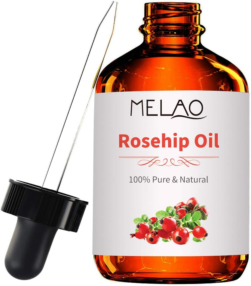 SAISZE Rosehip Oil for Face, Nails, Hair and Skin, 100% Pure & Natural, Cold Pressed Premium Rose Hip Seed Oil - 4 fl.oz