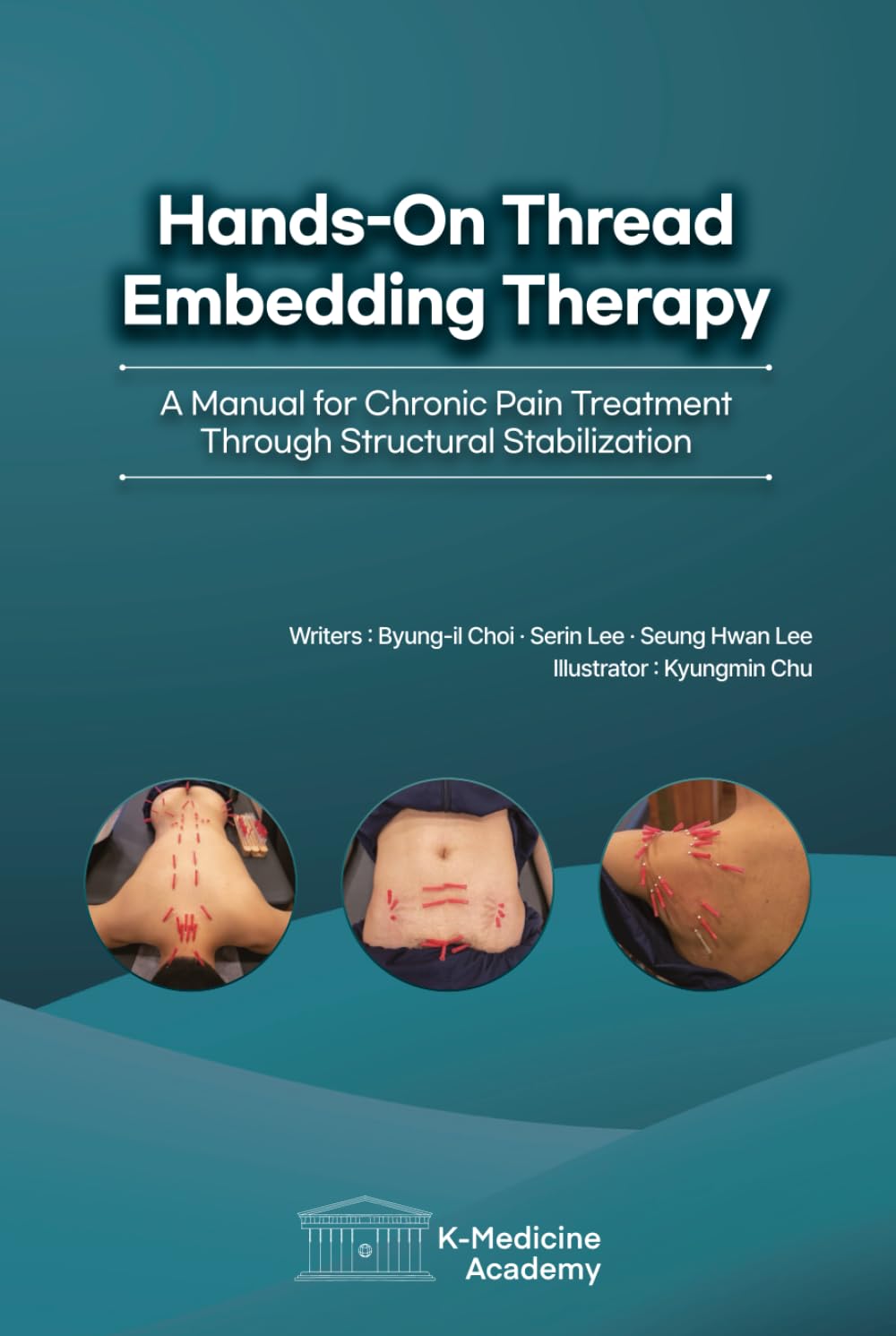 Hands-On Thread Embedding Therapy: A Manual for Chronic Pain Treatment Through Structural Stabilization