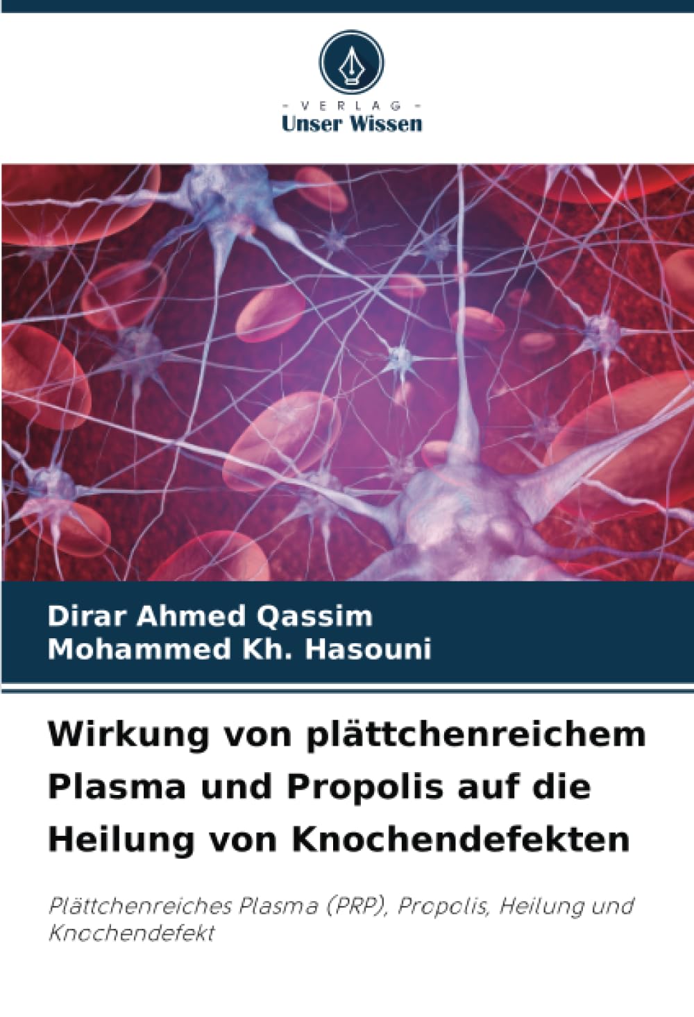 Wirkung von plättchenreichem Plasma und Propolis auf die Heilung von Knochendefekten: Plättchenreiches Plasma (PRP), Propolis, Heilung und Knochendefekt (German Edition)