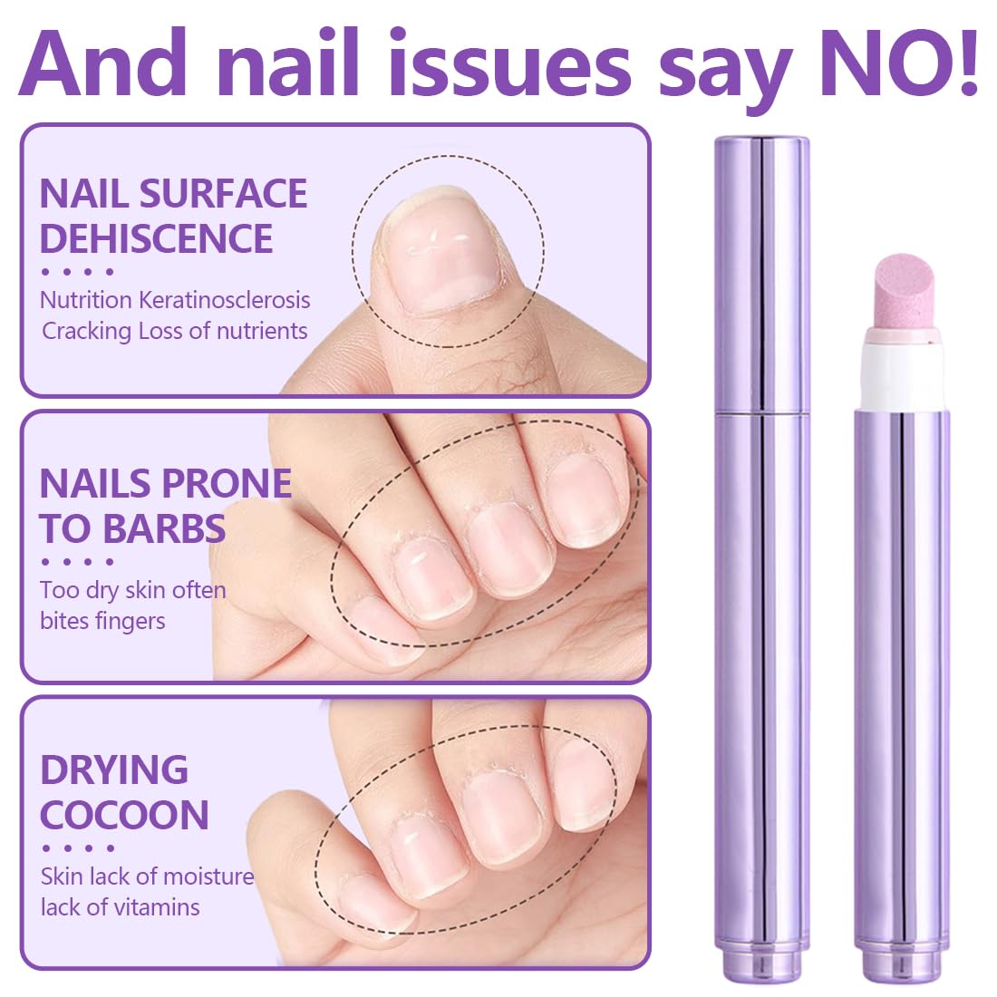 Penna Cuticole Unghie - Nail Care Pen con Olio Idratante, Penna per Cuticole Rimuovi e Nutre, Cura Mani e Unghie Fragili