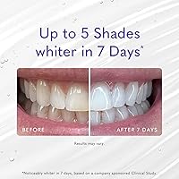 Vista 4 de Smileactives Gel blanqueador dental para pasta de dientes con peróxido de hidrógeno de grado clínico, removedor de manchas de dientes para dientes