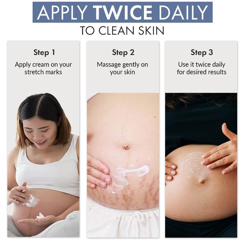 Thrive..Co. Stretch Marks Expert Serum Cream | For New (red) & Old (white) Stretch Marks Removal & Skin Hydration | Powered by Striover™, Rosehip Oil & Squalane | For Men & Women | 30ml