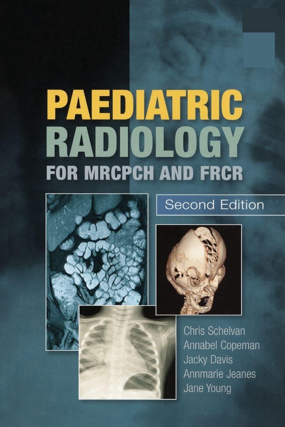 Paediatric Radiology for MRCPCH and FRCR, Second Edition - 9781853157028