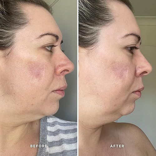 Miniatura 6 de ALPHA-H  Suero de vitamina A con retinol al 0,5%