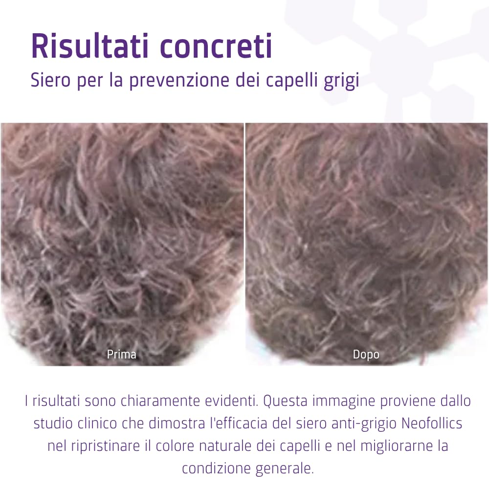 Neofollics Anti Grey Hair Serum - 90 ml - Diminuisce l'aspetto dei capelli grigi in 90 giorni - Ripristina il colore naturale dei capelli - Nutre il cuoio capelluto