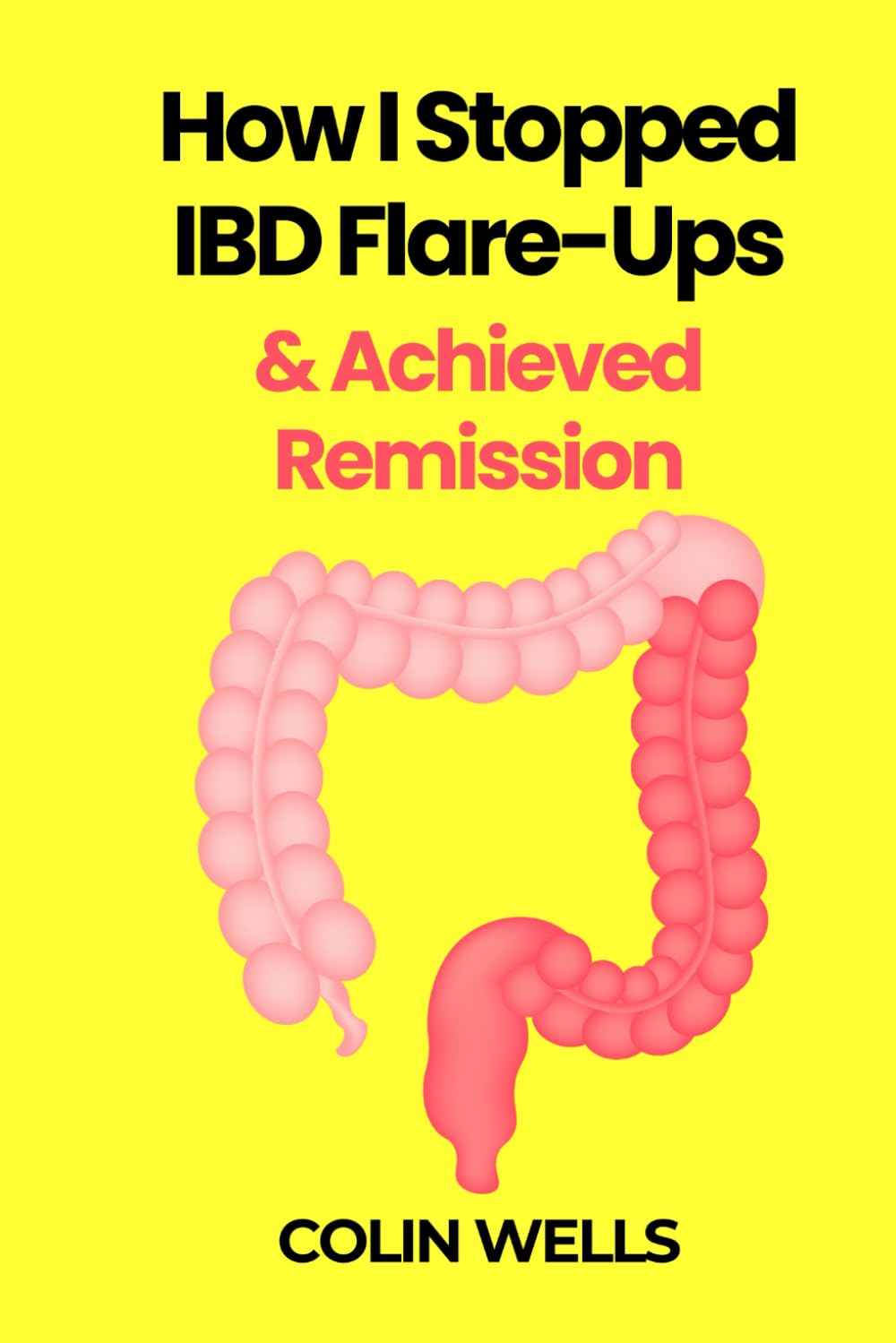 How I Stopped IBD Flare-Ups & Achieved Remission - How To Heal Crohn’s Disease & Ulcerative Colitis Naturally: Treat & Fix The Root Cause Of Leaky Gut & Autoimmune Inflammation Holistically With Diet
