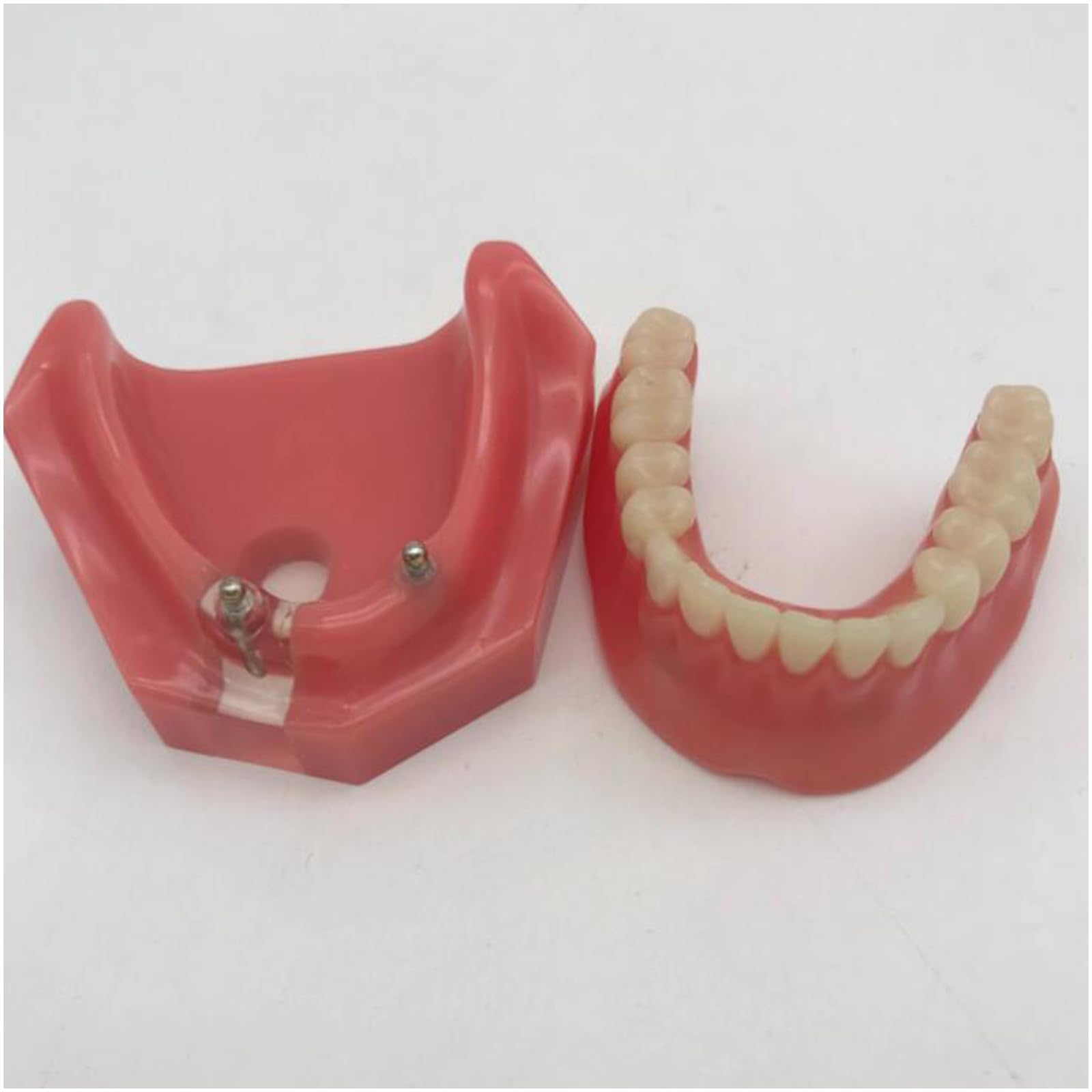 Modello di Denti dentali, Modello di restauro Dentale con 2 impianti, per Laboratorio odontotecnico di Ricerca didattica odontoiatrica