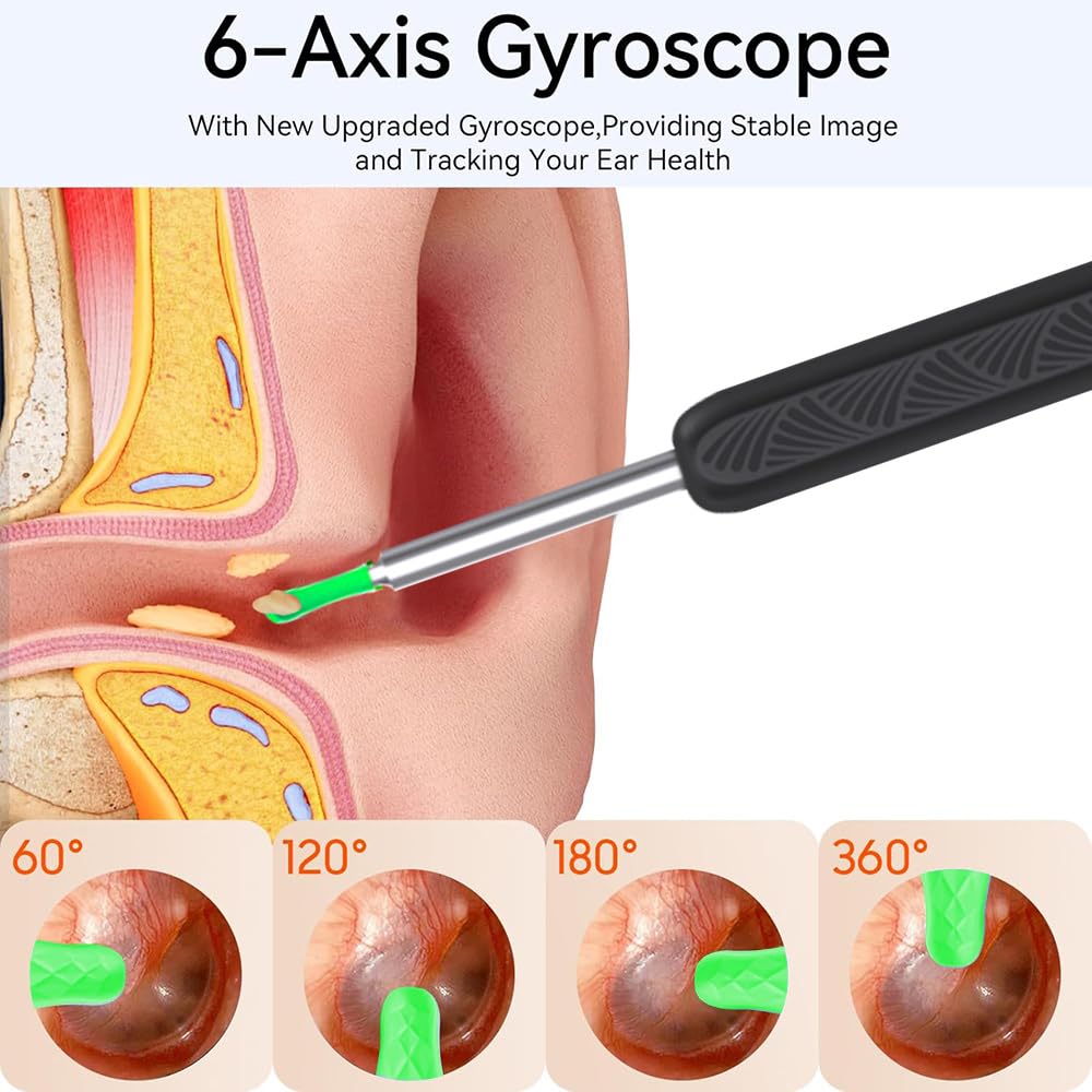 Ear Wax Removal - Earwax Remover Tool with 8 Pcs Ear Set - Ear Canal Cleaner with 1080P Camera - FSA HSA Eligible - Ear Cleaning Kit with 8 Ear Spoon - Ear Camera for iOS & Android (Black)