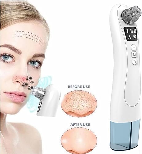 Miniatura 2 de Removedor de puntos negros, aspiradora de poros, espátula para la piel, herramienta extractora eléctrica de espinillas de comedones para acné,