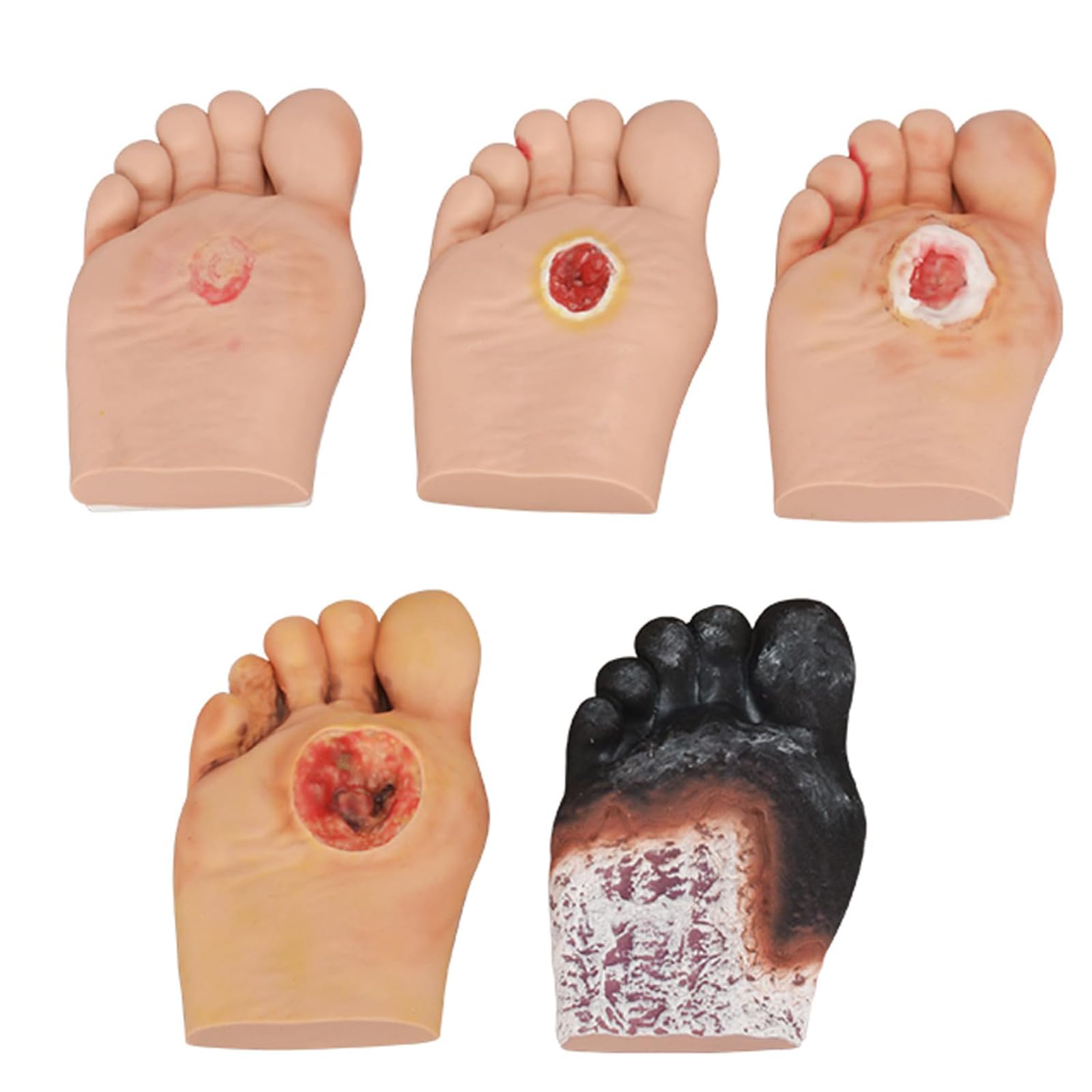 Model pielęgnacji stóp cukrzycowych do demonstracji anatomii i pielęgnacji ran, patologiczne zmiany owrzodzeń stóp, symulator stopy cukrzycowej z stopniowaną płytką na stopy