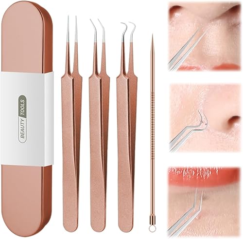 Vista 11 de Usiveinborn - Removedor de puntos negros mejorado, pinzas Usiveinborn para puntos negros, pinzas profesionales mejoradas para eliminar puntos