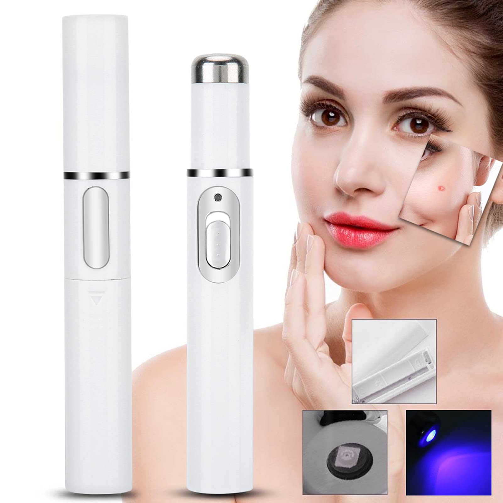 Blue Light Therapy Pen - Anti-Acne Treatment and Skin Repair for Elasticity  : Amazon.com.be: Beauty