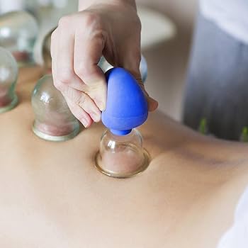 Amazon.co.jp: 4個カッピング療法セット、ガラス面カッピングセット