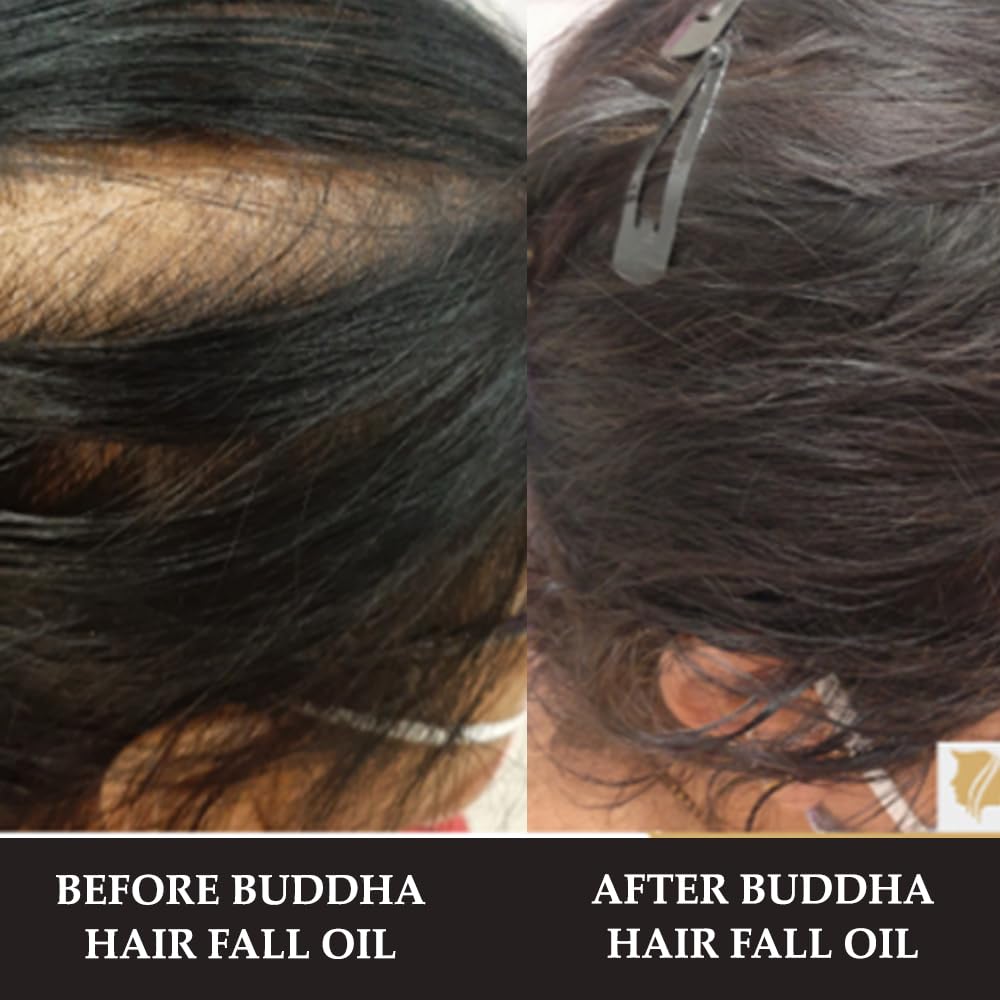Buddha Natural Fall of Hair Oil for Teenagers (200ml) - 100% Ayush Certified - For Reduce Thinning and Fall of Hair - Natural Herbs oil